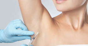 Как лечат гипергидроз подмышек?