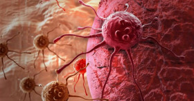 Как вылечить рак?