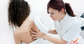 Меланома – признаки заболевания