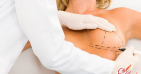 Процесс реабилитации после маммопластики