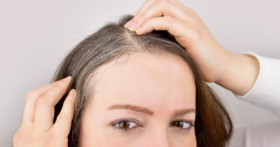 Редкие волосы причины поредения, полезный состав средств для восстановления густоты