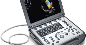 Как применяют УЗИ аппараты в акушерском деле