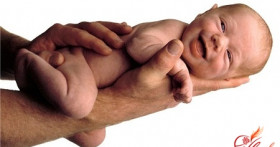 Асфиксия новорожденных. Симтомы, лечение