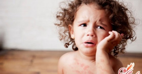 Сыпь у ребенка: как помочь до прихода врача