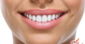 Не дайте герпесу испортить улыбку!