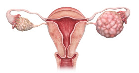 Этапы диагностики перед оперативным лечением рака яичника