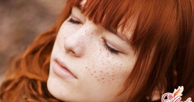 Как избавиться от пигментных пятен: эффективные методы