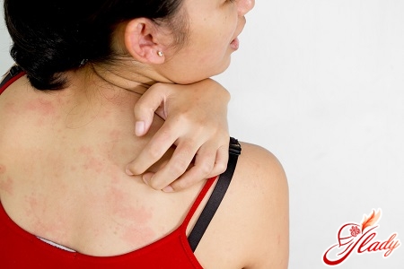 неприятная аллергия на коже 