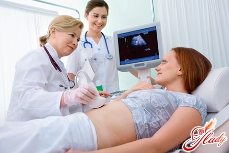 белые выделения при беременности на ранних сроках
