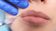 Самые эффективные процедуры для преображения внешности