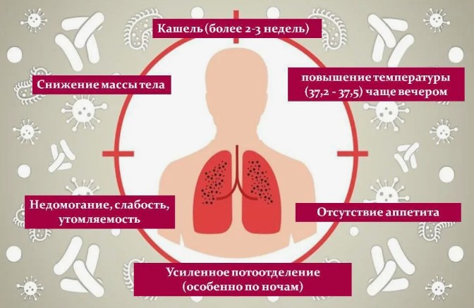 Симптомы туберкулеза