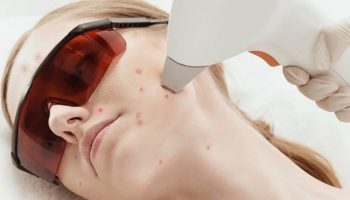 Эффективные процедуры от постакне