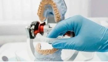 Сплинт-терапия в стоматологической клинике: эффективное решение проблем ВНЧС