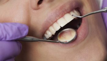 Лечение периодонтита и гигиеническая чистка зубов: современные методы сохранения здоровья полости рта